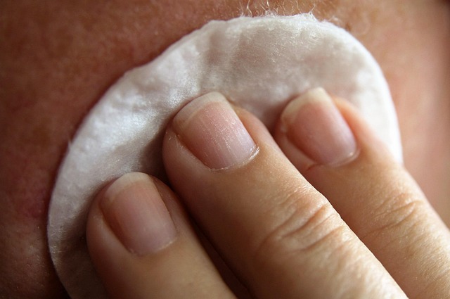 Imagem editorial de atendimento e cuidado profissional para peeling de diamante em Londrina, imagem 3.